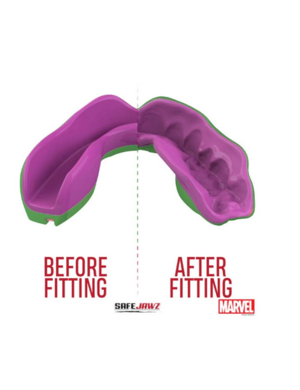 PROTEGE DENTS SAFEJAWS HULK ENFANT